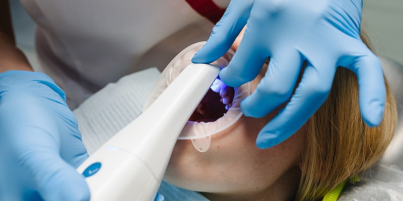 Intraoral Scanner